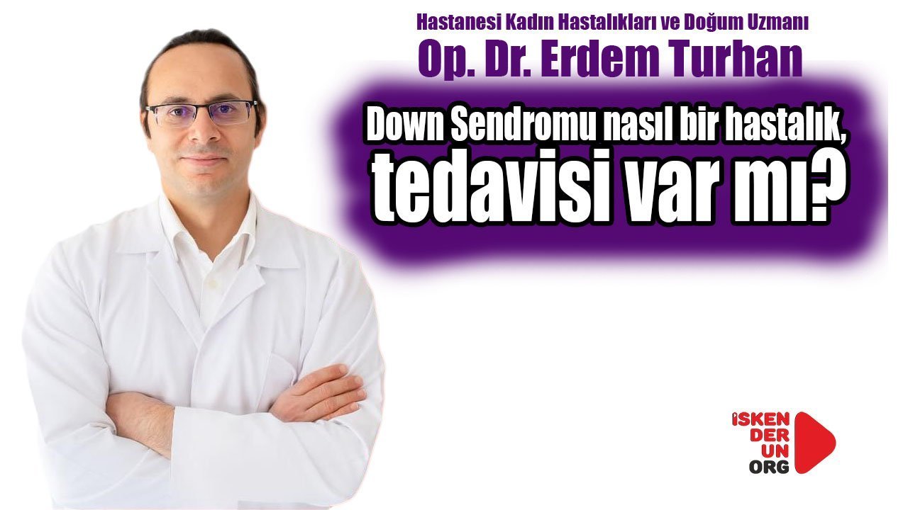 Down Sendromu nasıl bir hastalık, tedavisi var mı?