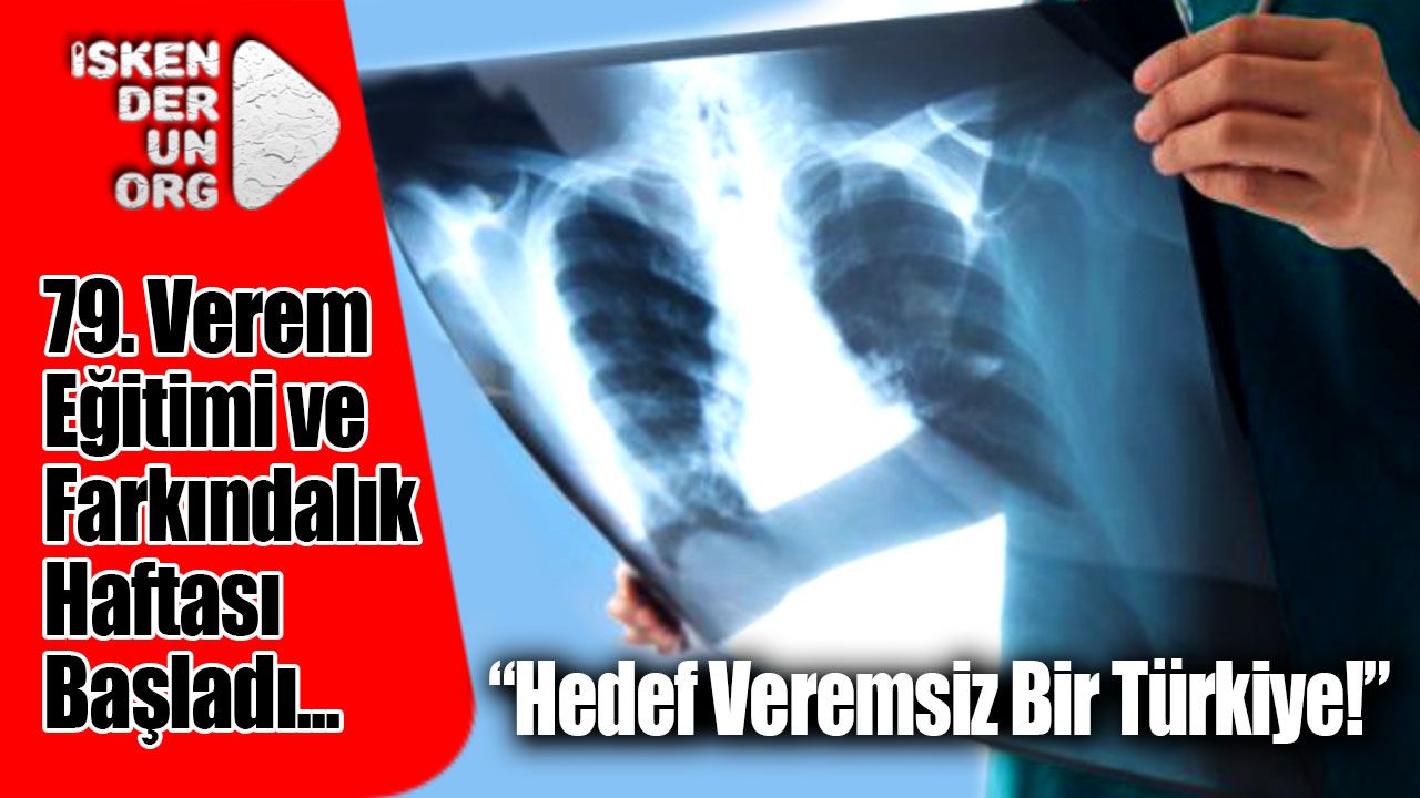 79. Verem Eğitimi ve Farkındalık Haftası Başladı