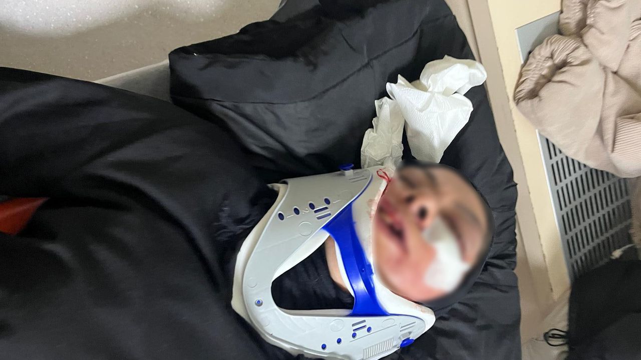 Açık su kanalına düşen kadın hastanelik oldu!