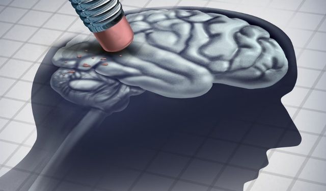 Alzheimer başlangıcı depresyonla karıştırılıyor