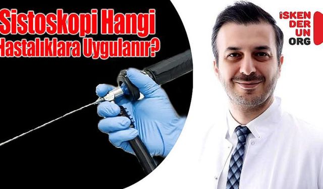 Sistoskopi Hangi Hastalıklara Uygulanır?