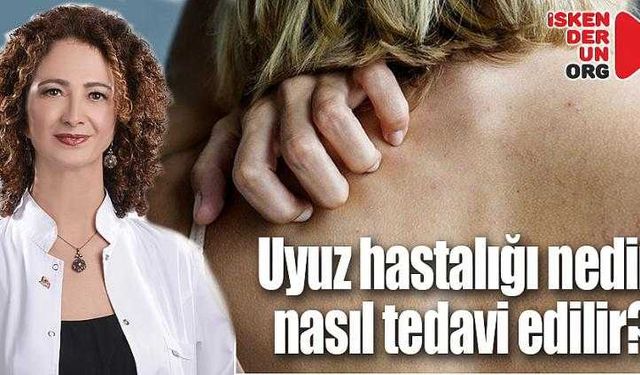 Uyuz hastalığı nedir, nasıl tedavi edilir?