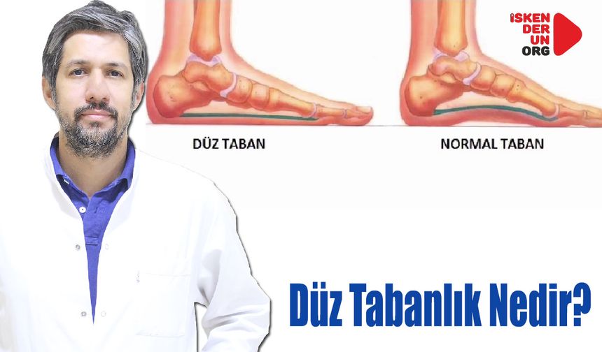 Düz Tabanlık Nedir?